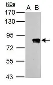 Anti-Influenza A virus PB2 protein antibody used in Western Blot (WB). GTX125926